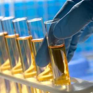 Kako se i koji identificira kemijsko-toksikološku analizu urina?