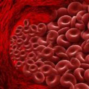 Kako smanjiti hemoglobina u krvi: prehrana, lijekovi i tradicionalni recepti