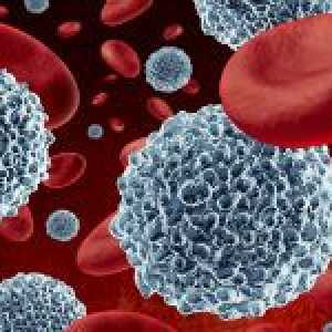 Kako smanjiti bijelih krvnih stanica u krvi