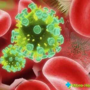 Kako bi stekli HIV infekcije: sve što trebate znati o virusu