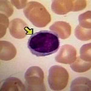 Što je stopa limfocita u krvi i njihovih funkcija