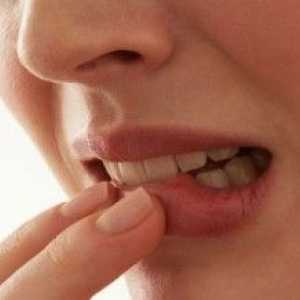 Oralna kandidijaza: Simptomi i liječenje