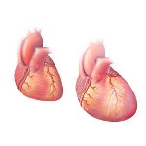 Kardiomcgalijc: oba oblika, simptomi, dijagnoza, posebno u djece, liječenje