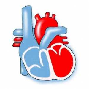 Različiti tipovi kardiomiopatije: pojava, dijagnoza i liječenje bolesti