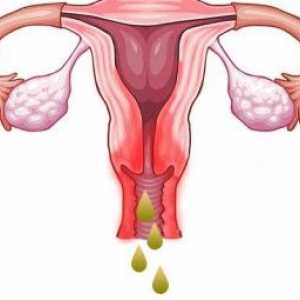 Coleitis za vrijeme menstruacije
