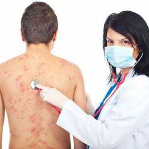 Kožni osip u alergije