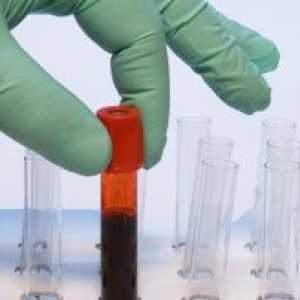 Krv na RV za iznajmljivanje na prazan želudac: glavni preporuke u pripremi prije analize