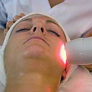 Lasersko uklanjanje akni - moderan način dobivanja osloboditi od acne!