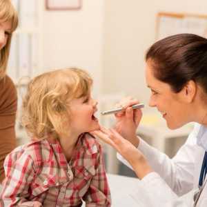 Liječenje infektivne mononukleoze u djece