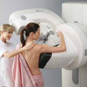Mamografija: indikacije, kontraindikacije, te na koji dan napraviti mamografiju