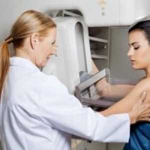 Mamografija: trošak i korist metode
