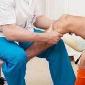 Lijek i bez lijeka za liječenje artritisa koljena