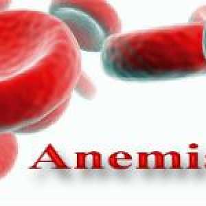 Megaloblastična (megaloblastična) anemija