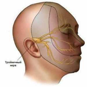 Metode liječenja trigeminalna neuralgija