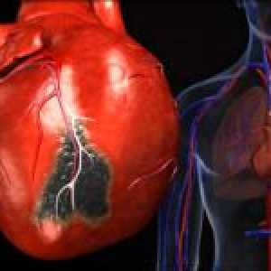 Povećanje lijeve klijetke srca