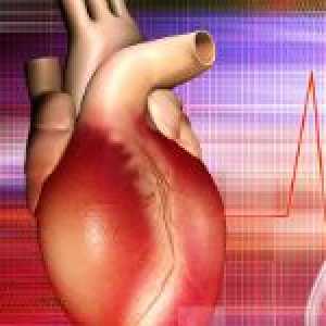 Miokarditis - upala srčanog mišića