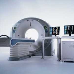 MRI i CT - što je bolje?