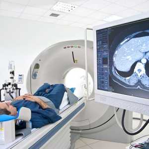 MRI gušterače, najbolja metoda dijagnoze