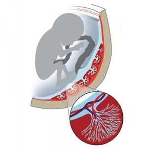 Oslabljeno protok krvi u arterijama maternice, pupčana vrpca, placenta tijekom trudnoće (nmpk)