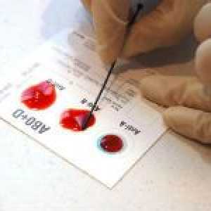 Kompatibilnost i neusklađenost krvnih grupa i rezus faktora