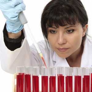 Norma hemoglobina u žena