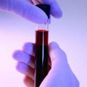 Norma u krvi neutrofila u djece i uzroci odstupanja