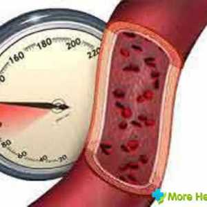 Što mogu posvjedočiti sniziti visoki krvni tlak?