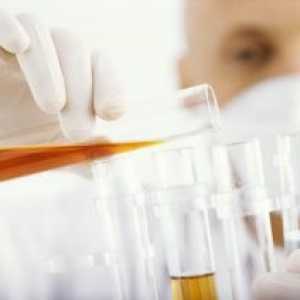 Analiza mokraće in vitro: svrha i prijepis analiza