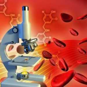 Opće i biokemijska analiza krvi. prijepis