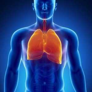 Žarišna upala pluća - što je to? Glavni simptomi