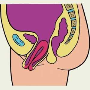 Izostanak maternice i vagine