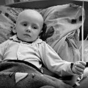 Glavni uzroci akutne leukemije u djece i odraslih