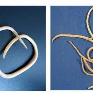 Pinworm i roundworm razlika: postupci liječenja infekcije i