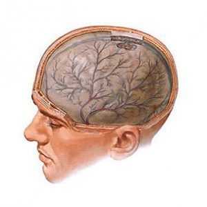 Cerebralni edem: uzroci i oblici, simptomi, liječenje, komplikacije i prognoza