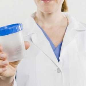 Paraziti u urinu: Vrste i liječenje