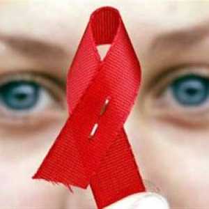 Prvi znakovi AIDS-a i pozornice, kako prepoznati bolest kod kuće