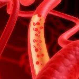 Kako ojačati krvne žile?