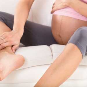 Uzroci nogu edema u trudnoći i liječenje