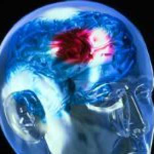 Posljedice i prognoza nakon hemoragijski moždani udar