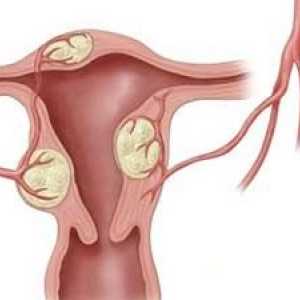 Ginekoloških bolesti za vrijeme menopauze