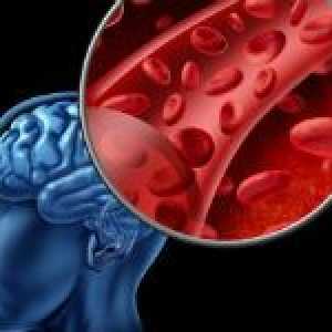 Lijekovi koji poboljšavaju protok krvi u mozgu