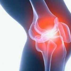 Uzroci i liječenje bolova u zglobovima u menopauzi