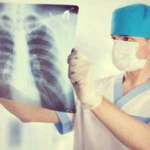 Uzroci i liječenje intersticijske plućni edem