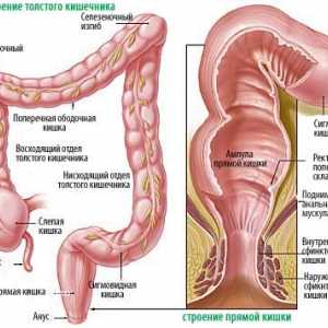 Uzroci i liječenje upale debelog crijeva