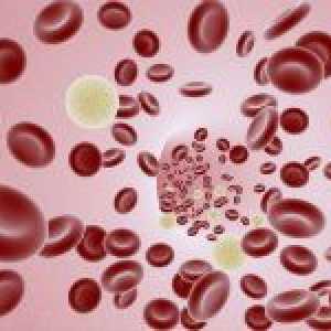 Razloga i metode liječenja niske leukocita u krvi