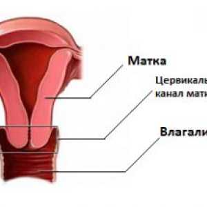 Uzroci grlića maternice u žena u postmenopauzi