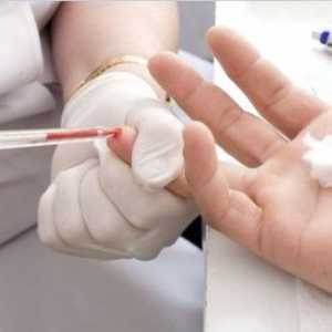 Uzroci, simptomi i liječenje niskog hemoglobina