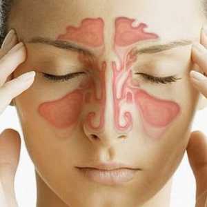 Znakovi i simptomi sinusitisa