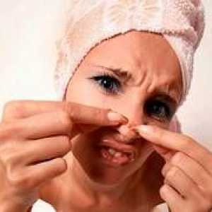 Terapeut pomaže da biste dobili osloboditi od acne