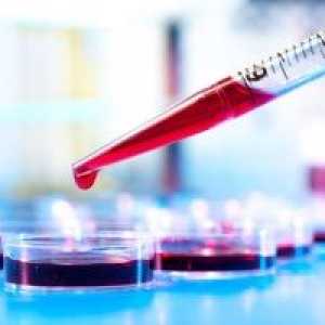 Dešifriranja opću analizu krvi kod žena: norma i patologije